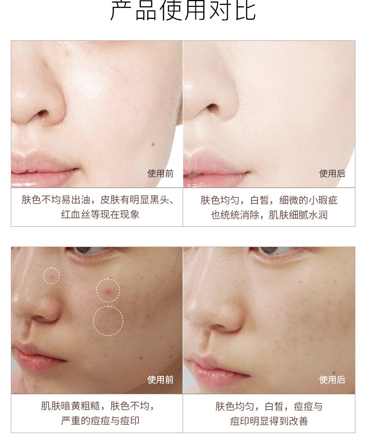 PERFECT ONE Moisture Gel 75g - Japan Online Shopping - Hommi