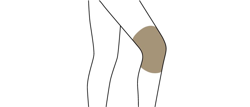 ITRIM Crescent 月梢膝部養護精華 25g 緊致抗衰防暗沉商品描述