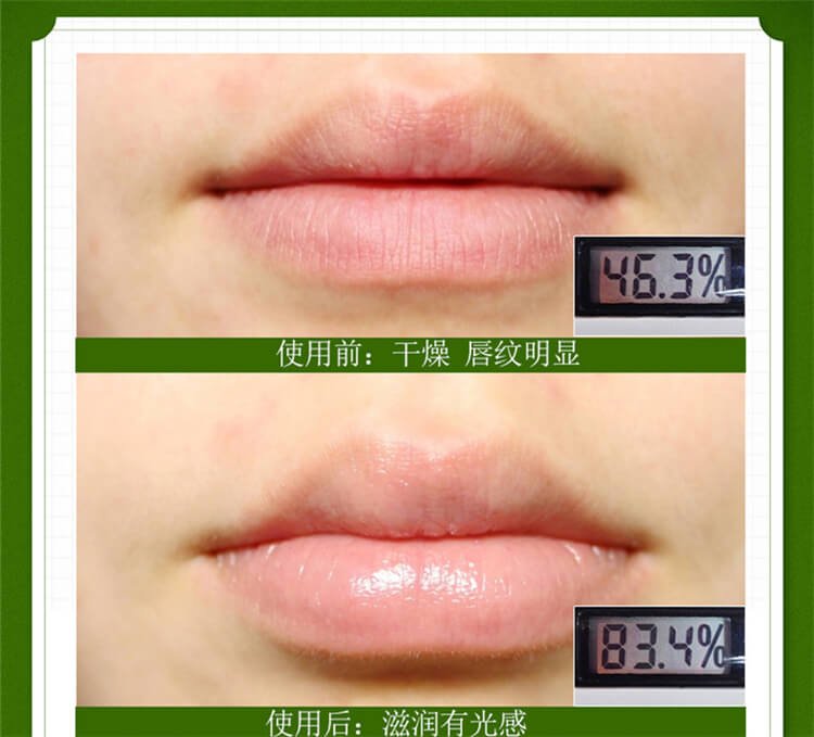 Mentholatum Unisex Moisturizing Moisturizing Lip Balm Mint Lips