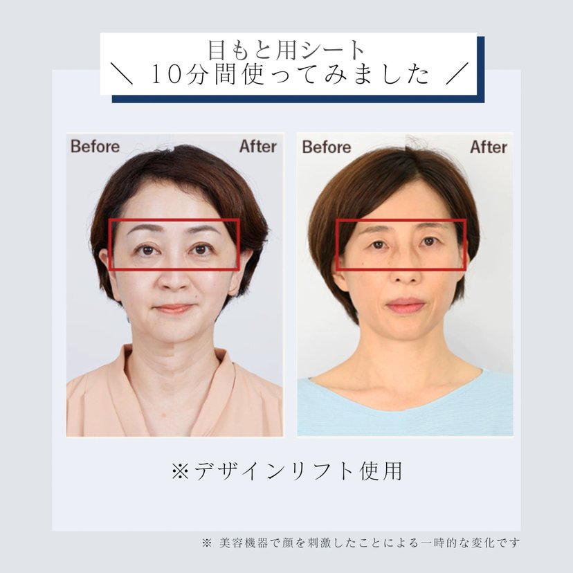 Yaman Design Lift More-Japan Online Shopping - Hommi